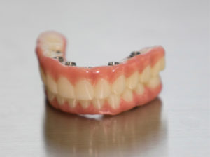 Dental Milling Solutions Implants